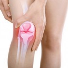 Gekneusde knie: symptomen, oorzaken, behandeling en prognose