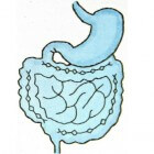 Inflammatoire darmziekten: colitis ulcerosa en morbus Crohn