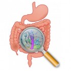 Ziekte van Crohn: Aandoening met diarree en buikpijn