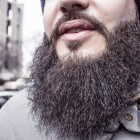 Alopecia barbae: Haaruitval aan baardgebied bij mannen