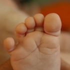 Gevoelloze tenen: oorzaken en symptomen gevoelloosheid tenen