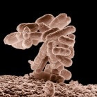 Escherichia coli (E. coli): Bacteriële infectie