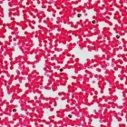 Neutrofielen: Abnormale niveaus van soort witte bloedcellen