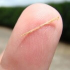 Splinter: Typen en verwijdering van splinters uit huid