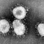 Coronavirus: symptomen, oorzaken, behandeling & complicaties