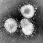 SARS-coronavirus: symptomen, oorzaken en behandeling