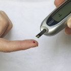 Diagnose diabetes