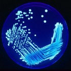 Legionella (bacterie), veteranenziekte: symptomen, klachten