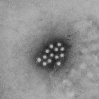 Hepatitis A: symptomen, behandeling en vaccinatie