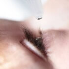 Blepharospasme: ongewoon veel knipperen en oogspierspasme