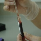 Bloedonderzoek: CRP, wat is dat?