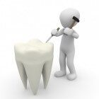 Afgebroken tand: oorzaken, behandeling, wat te doen
