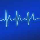 Hoe werkt een Holteronderzoek voor het hart?