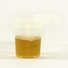 Een beker urine drinken, gezond of een fabeltje?