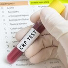 CRP-waarden bloedtest of sneltest: te hoge ontstekingswaarde