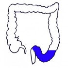 Sigmoïd (colon sigmoideum): anatomie, functie en locatie
