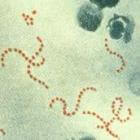 Soorten antibiotica: penicillines (o.a. Broxil, Augmentin)