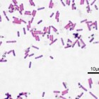 Paratyfus door Salmonella besmetting