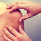 Huidkanker: symptomen, herkennen, oorzaak en behandeling