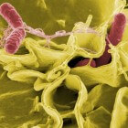 Salmonella: besmetting, behandeling en preventie