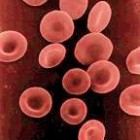 Afwijkingen van het rode bloed (anemie / bloedarmoede)