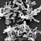 Ziek door de Clostridium difficile bacterie: informatie