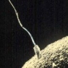 Het invriezen van sperma (zaad of zaadcellen)