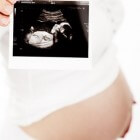 Zwangerschapsechografie: Beeld van ontwikkeling baby