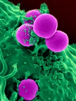 Meticilline-resistente Staphylococcus aureus ofwel de ziekenhuisbacterie / Bron: National Institutes of Health (NIH), Wikimedia Commons (Publiek domein)