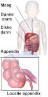 Anatomische locatie appendix / Bron: Blausen.com, Wikimedia Commons (CC BY-3.0)