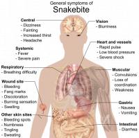 Verschillende symptomen van slangenbeten / Bron: Mikael Häggström, Wikimedia Commons (Publiek domein)