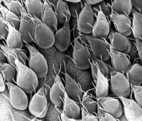 Darm van een gerbil geïnfecteerd met Giardia parasieten, zeer sterk vergroot / Bron: Dr. Stan Erlandsen (1988), Wikimedia Commons (Publiek domein)