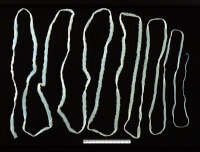 een volwassen lintworm kan meterslang worden / Bron: Publiek domein, Wikimedia Commons (PD)