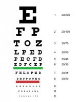 Een jaarlijks oogonderzoek is nodig bij patiënten met het syndroom van Down / Bron: Jeff Dahl, Wikimedia Commons (CC BY-SA-3.0)