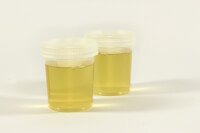 Een urineonderzoek is vereist om de oorzaak op te sporen van de slijm in de urine / Bron: Frolicsomepl, Pixabay