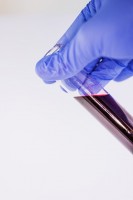 Een bloedonderzoek (genetisch onderzoek) is nodig voor het stellen van de diagnose / Bron: Frolicsomepl, Pixabay