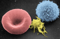Erytrocyt, leukocyt en trombocyt (bloedplaatje) / Bron: Electron Microscopy Facility (NCI Frederick), Wikimedia Commons (Publiek domein)