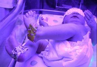 Lichttherapie bij pasgeborene met geelzucht / Bron: Woodleywonderworks, Flickr (CC BY-2.0)