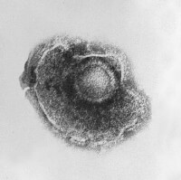 Het varicella-zoster virus onder de microscoop / Bron: CDC/Dr. Erskine Palmer/B.G. Partin, Wikimedia Commons (Publiek domein)