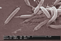 De Helicobacter pylori / Bron: Dr. Patricia Fields, Dr. Collett, Wikimedia Commons (Publiek domein)