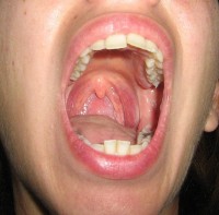 Menselijke mond / Bron: Lusb, Wikimedia Commons (CC BY-3.0)