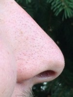 Een droge neus kent meerdere mogelijke oorzaken / Bron: TheNoseKnows2Much, Wikimedia Commons (CC BY-SA-4.0)