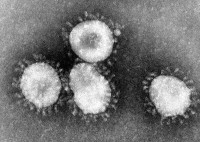 Coronavirussen zijn een groep virussen waarvan bekend is dat ze verkoudheid veroorzaken. Ze zien er halo of kroonachtig (corona) uit wanneer ze onder een elektronenmicroscoop worden bekeken. / Bron: Photo Credit: Content Providers(s): CDCDr. Fred Murphy, Wikimedia Commons (Publiek domein)