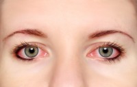 Rode ogen door ibuprofen / Bron: Cessna152/Shutterstock.com