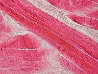 Overlangs aangesneden dwarsgestreepte spiercellen / Bron: Department of Histology, Jagiellonian University Medical College, Wikimedia Commons (CC BY-SA-3.0)