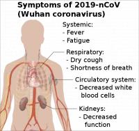 Symptomen van COVID-19 (Wuhan coronavirus) / Bron: Mikael Häggström, Wikimedia Commons (CC0)