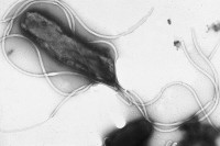 Helicobacter pylori / Bron: Yutaka Tsutsumi, Wikimedia Commons (CC0)