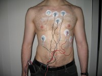 Holter-ecg of Holter-monitor / Bron: Jason7825, Wikimedia Commons (CC BY-SA-3.0)