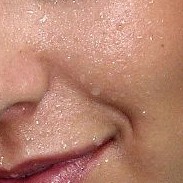 Koud zweet in het gezicht / Bron: Bibikoff, Wikimedia Commons (CC BY-3.0)
