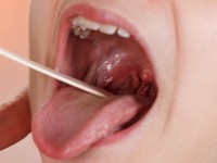 Huisarts onderzoekt mond en keel / Bron: BravissimoS/Shutterstock.com